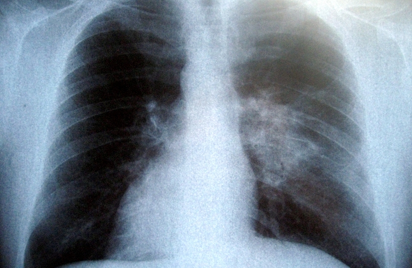lungs