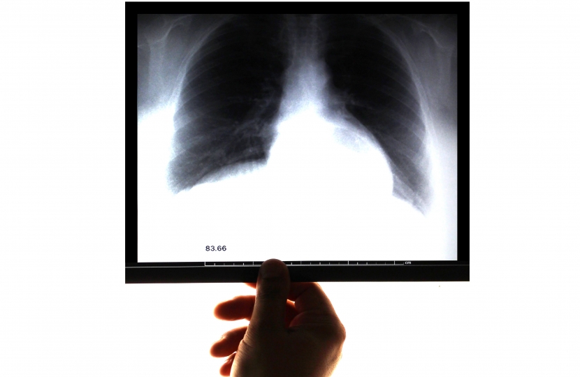 lung x ray