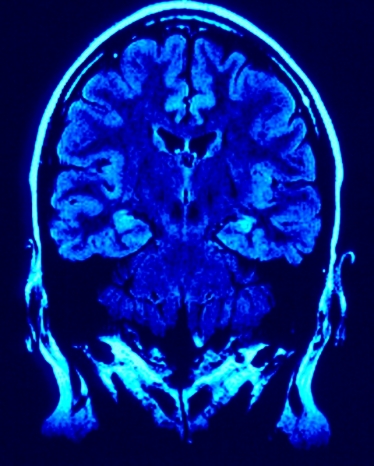 neuro